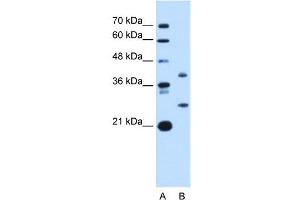 ST8SIA2 antibody used at 1 ug/ml to detect target protein. (ST8SIA2 antibody  (C-Term))