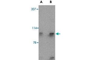 Western blot analysis of SLITRK4 in mouse brain tissue lysate with SLITRK4 polyclonal antibody  at (A) 0. (SLITRK4 antibody  (N-Term))