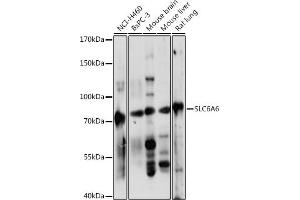 Western blot analysis of extracts of various cell lines, using SLC6 antibody (ABIN7270739) at 1:1000 dilution. (TAUT antibody  (AA 250-320))