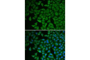 Immunofluorescence analysis of HeLa cells using CHEK2 antibody. (CHEK2 antibody)