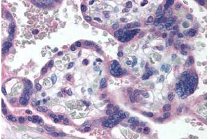 Human Placenta (formalin-fixed, paraffin-embedded) stained with TP73 antibody ABIN290399 at 5 ug/ml followed by biotinylated anti-mouse IgG secondary antibody ABIN481714, alkaline phosphatase-streptavidin and chromogen.