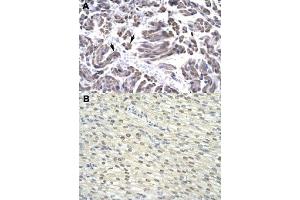 Immunohistochemical staining (Formalin-fixed paraffin-embedded sections) of human muscle (A) and human heart (B) with GTF2H3 polyclonal antibody  at 4-8 ug/mL working concentration. (GTF2H3 antibody  (N-Term))