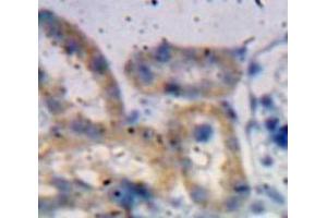 Used in DAB staining on fromalin fixed paraffin-embedded Kidney tissue (ADAMTS1 antibody  (AA 855-968))