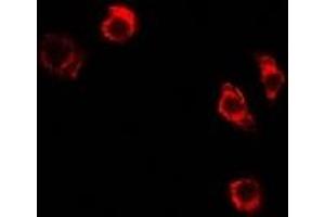 Immunofluorescent analysis of MTHFD1L staining in A549 cells. (MTHFD1L antibody)