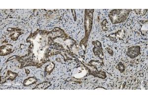 IHC analysis of U2AF65/U2AF2 using anti U2AF65/U2AF2 antibody (ABIN7600794). (U2AF2 antibody  (AA 238-470))