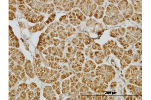 Immunoperoxidase of monoclonal antibody to CENPJ on formalin-fixed paraffin-embedded human pancreas. (CENPJ antibody  (AA 979-1088))