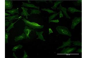 Immunofluorescence of monoclonal antibody to SLC3A1 on HeLa cell.