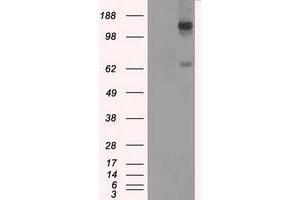 Image no. 2 for anti-L1 Cell Adhesion Molecule (L1CAM) antibody (ABIN1499088) (L1CAM antibody)