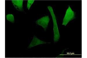 Immunofluorescence of monoclonal antibody to RAC2 on HeLa cell. (RAC2 antibody  (AA 1-192))