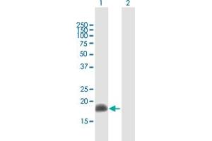 Western Blot analysis of ARL2 expression in transfected 293T cell line by ARL2 MaxPab polyclonal antibody. (ARL2 antibody  (AA 1-184))