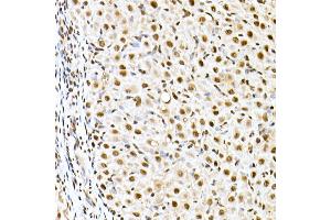 Immunohistochemistry of paraffin-embedded rat ovary using ID2 Rabbit pAb (ABIN3021261, ABIN3021262, ABIN3021263 and ABIN6214091) at dilution of 1:50 (40x lens).