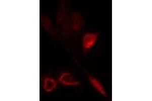 ABIN6275795 staining  HeLa cells by IF/ICC. (ANAPC5 antibody  (Internal Region))