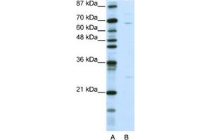 Western Blotting (WB) image for anti-Kelch-Like 13 (KLHL13) antibody (ABIN2461016) (KLHL13 antibody)