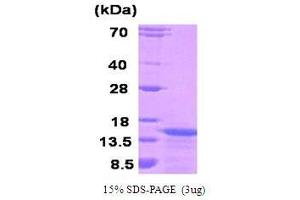 Figure annotation denotes ug of protein loaded and % gel used. (KISS1 Protein (AA 1-120))