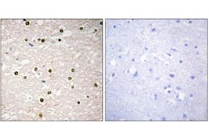 Immunohistochemistry analysis of paraffin-embedded human brain tissue, using p73 antibody. (Tumor Protein p73 antibody  (Internal Region))