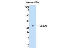 Western Blotting (WB) image for anti-Cytochrome P450, Family 2, Subfamily D, Polypeptide 6 (CYP2D6) (AA 236-472) antibody (ABIN1176089) (CYP2D6 antibody  (AA 236-472))