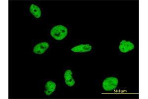 Immunofluorescence (IF) image for anti-Nuclear Mitotic Apparatus Protein 1 (NUMA1) (AA 1-1193) antibody (ABIN1327330)