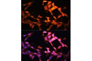 Immunofluorescence analysis of NIH/3T3 cells using FLCN antibody (ABIN7267226) at dilution of 1:100. (FLCN antibody  (AA 1-130))
