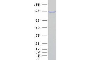 Validation with Western Blot (RBM5 Protein (Myc-DYKDDDDK Tag))