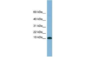 WB Suggested Anti-B2M Antibody Titration: 0. (beta-2 Microglobulin antibody  (N-Term))