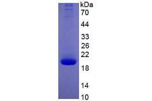 Image no. 1 for Interleukin 10 (IL10) (AA 19-178) (Active) protein (His tag) (ABIN6239730) (IL-10 Protein (AA 19-178) (His tag))