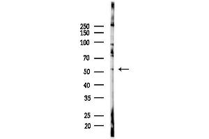 anti-Vaccinia Related Kinase 3 (VRK3) (Internal Region) antibody