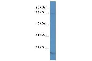 Western Blot showing KCNA5 antibody used at a concentration of 1. (KCNA5 antibody  (N-Term))