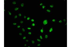 Immunofluorescence staining of Hela cells with ABIN7155669 at 1:100, counter-stained with DAPI. (CUX1 antibody  (AA 24-94))