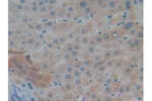 Detection of MUC5AC in Human Liver Tissue using Polyclonal Antibody to Mucin 5 Subtype AC (MUC5AC) (MUC5AC antibody)