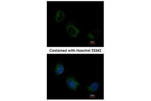 ICC/IF Image Immunofluorescence analysis of methanol-fixed HeLa, using EIF3F, antibody at 1:200 dilution. (EIF3F antibody)
