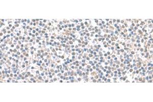 Immunohistochemistry of paraffin-embedded Human tonsil tissue using IFI27 Polyclonal Antibody at dilution of 1:100(x200) (IFI27 antibody)