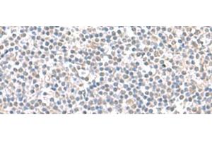 Immunohistochemistry of paraffin-embedded Human tonsil tissue using IFI27 Polyclonal Antibody at dilution of 1:100(x200)