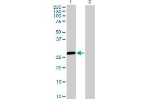 Western Blot analysis of HLA-DRB5 expression in transfected 293T cell line by HLA-DRB5 MaxPab polyclonal antibody.