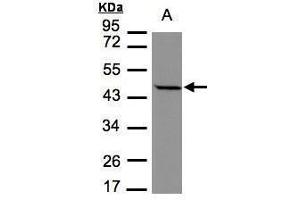 WB Image Sample(30 μg of whole cell lysate) A:MOLT4, 7. (STOML1 antibody)