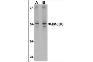 Western blot analysis of JMJD6 in human brain tissue lysate with this product at (A) 1 and (B) 2 μg/ml.