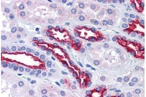 Kidney, Human: Formalin-Fixed, Paraffin-Embedded (FFPE) (MUC1 antibody)