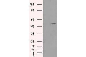 Western Blotting (WB) image for anti-Solute Carrier Family 2 (Facilitated Glucose/fructose Transporter), Member 5 (SLC2A5) antibody (ABIN1498476) (SLC2A5 antibody)