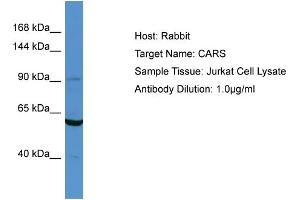 Host: Rabbit Target Name: CARS Sample Type: Jurkat Whole cell lysates Antibody Dilution: 1. (CARS antibody  (N-Term))