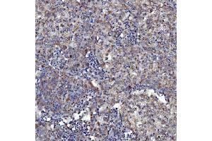 IHC analysis of SARS2 using anti-SARS2 antibody (ABIN7601804). (SARS2 antibody  (AA 46-518))
