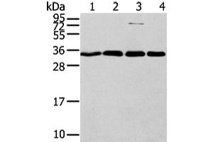 Western Blot analysis of Hela, Jurkat, 293T and lovo cell using CBX7 Polyclonal Antibody at dilution of 1/200 (CBX7 antibody)