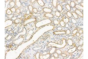 anti-Olfactory Receptor, Family 2, Subfamily AJ, Member 1 (OR2AJ1) (Internal Region) antibody
