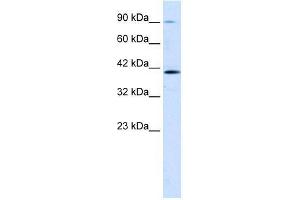 Human Jurkat; WB Suggested Anti-CCDC16 Antibody Titration: 1. (CCDC16 antibody  (Middle Region))