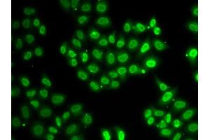 Immunofluorescence (IF) image for anti-Ewing Sarcoma Breakpoint Region 1 (EWSR1) antibody (ABIN1882293)