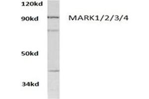 Image no. 1 for anti-MAP/microtubule Affinity-Regulating Kinase 1/2/3/4 (MARK1/2/3/4) antibody (ABIN317798) (MARK1/2/3/4 antibody)