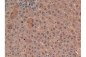 Used in DAB staining on fromalin fixed paraffin- embedded liver tissue (GSTP1 antibody  (AA 1-210))