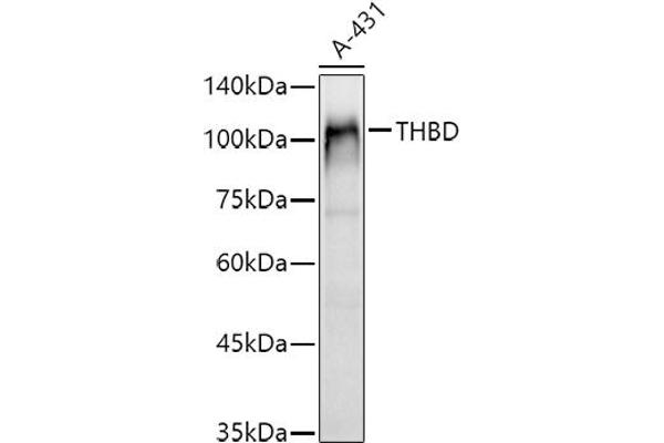 Thrombomodulin antibody  (AA 200-500)