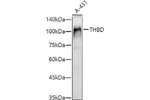 Western blot analysis of extracts of A-431 cells, using THBD antibody (ABIN1683026, ABIN3018621, ABIN3018622 and ABIN6220518) at 1:1000 dilution. (Thrombomodulin antibody  (AA 200-500))