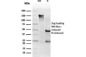 SDS-PAGE Analysis. (SMNDC1 antibody)