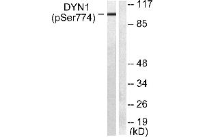 Western blot analysis of extracts from mouse brain cells, using Dynamin-1 (Phospho-Ser774) Antibody (#A0422). (Dynamin 1 antibody  (pSer774))