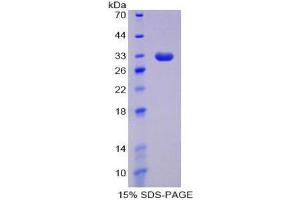 SDS-PAGE (SDS) image for DNA (Cytosine-5)-Methyltransferase 1 (DNMT1) (AA 1343-1570) protein (His tag) (ABIN2124660)